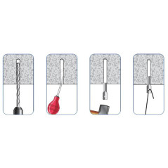 Cheville Suspente 20 pcs – Fixation Sécurisée – Idéale pour Plafonds et Murs - ALSAFIX
